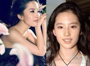 明星网红崴脚图片真实,现场照片曝光引网友关注