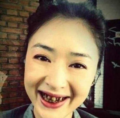 坏牙明星网红是谁呀,当红网红的“坏牙”之谜，明星网红的口腔护理之道