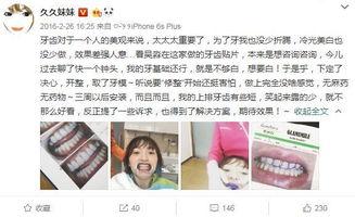 明星网红种牙是谁,揭秘种牙背后的故事与细节