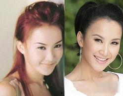 西安w明星网红整容医院