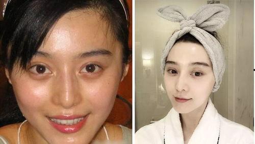 明星网红去的整容医院,美丽背后的秘密